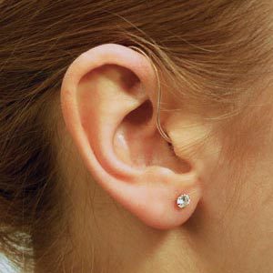 Hearing Aids